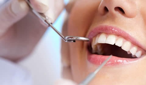 Implantes e manutenção – Odontologia